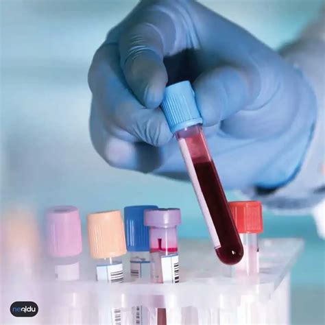 kan uyuşmazlığı testi nedir